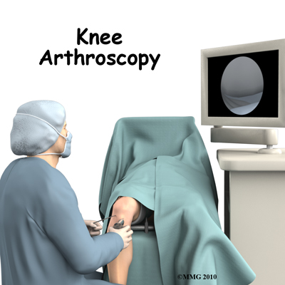 knee_arthroscopy_intro01