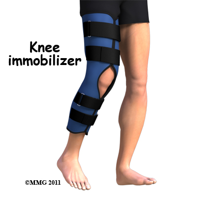 knee_bipartite_patella_adult_immobilizer