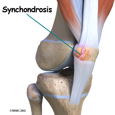 knee_bipartite_patella_child_causes