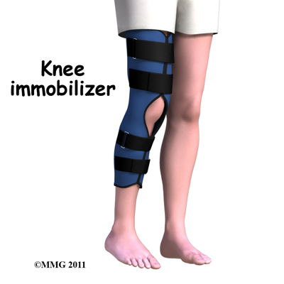 knee_bipartite_patella_child_immobilizer