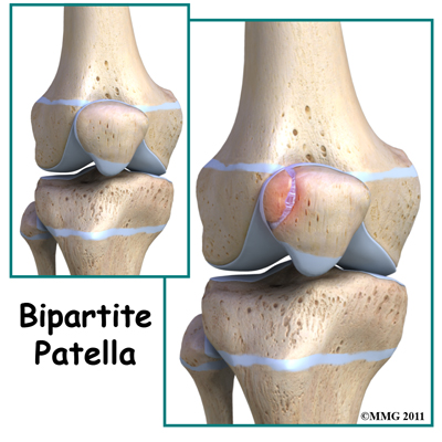 knee_bipartite_patella_child_intro
