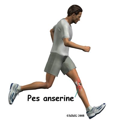 knee_bursitis_pes_anserine_cause01