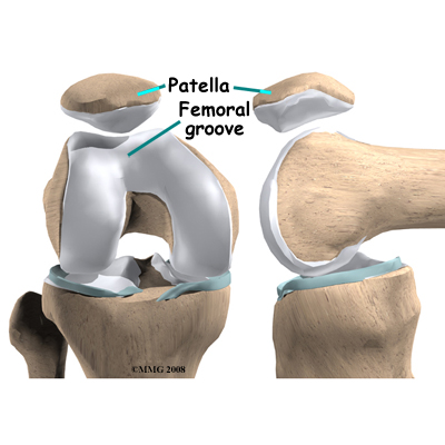 knee_chondromalacia_groove_anatomy03