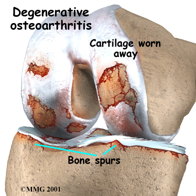 knee_glucosamine_anatomy02