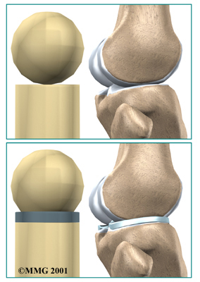 knee_meniscus_anatomy02