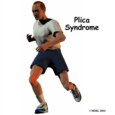 knee_plica_intro01