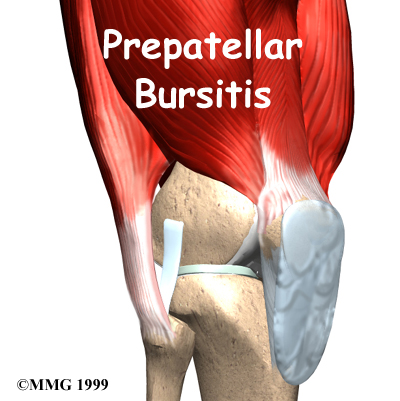 knee_prepatellar_intro01