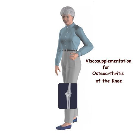 knee_viscosup_intro_knee