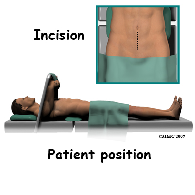lumbar_ADR_surgery01