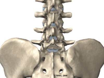 lumbar_laminectomy_anatomy01