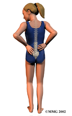 lumbar_spondylolysis_anatomy02