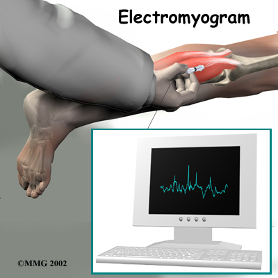 lumbar_stenosis_diagnosis04