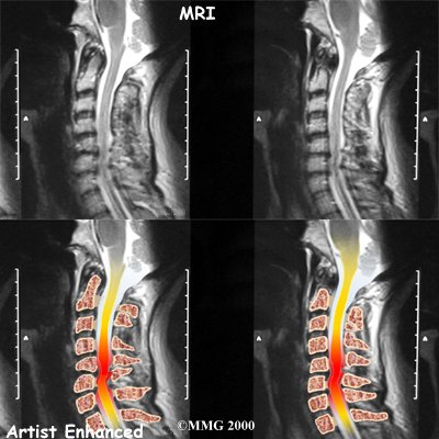 neck_pain_diagnosis01