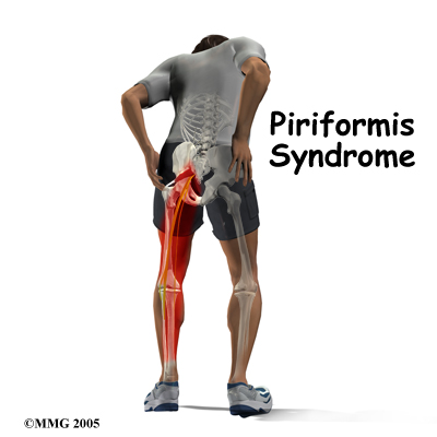 piriformis_intro01
