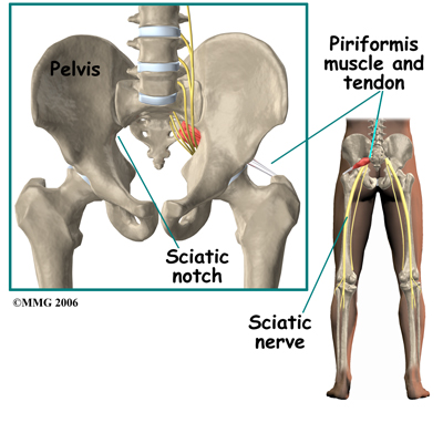 Piriformis Muscle Injections | Central Orthopedic Group