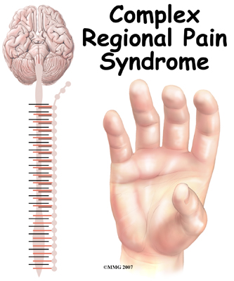 pm_general_crps_intro01