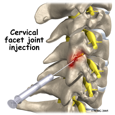 pm_general_fji_cervical
