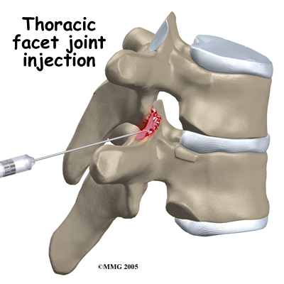 pm_general_fji_thoracic