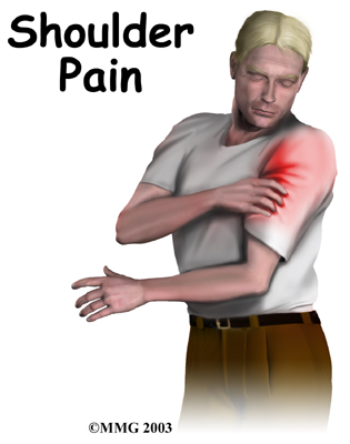 shoulder_biceps_tendonitis_symptoms01