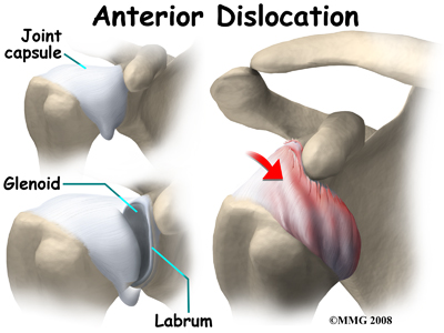 shoulder_dislocation_anatomy08