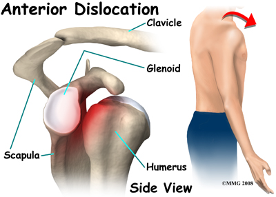 shoulder_dislocation_anatomy11
