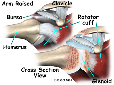shoulder_labral_tear_anat04