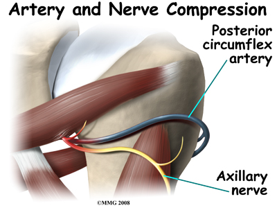 shoulder_quad_space_causes01