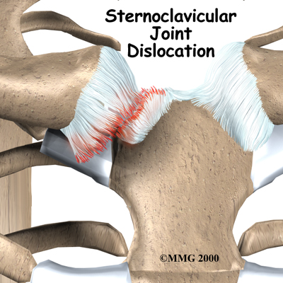 shoulder_stclav_intro01