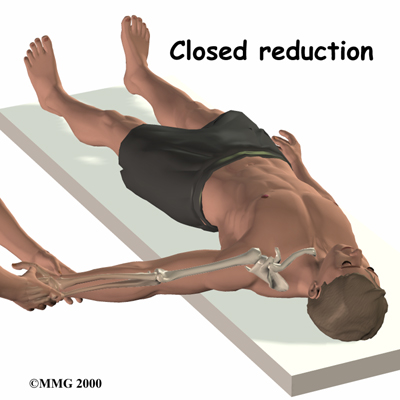 shoulder_stclav_treatment02
