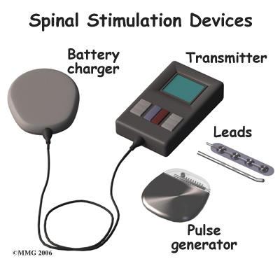 spinal_stim_devices01