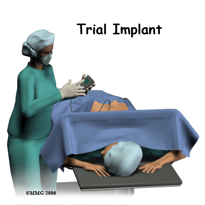 spinal_stim_surgery01
