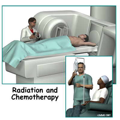spinal_tumor_treatment01