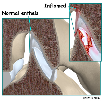 spondylo_anatomy03
