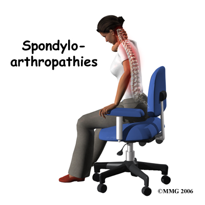 spondylo_intro01