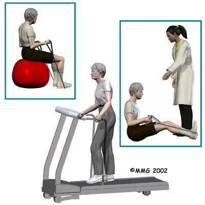 thoracic_vertebroplasty_rehab01