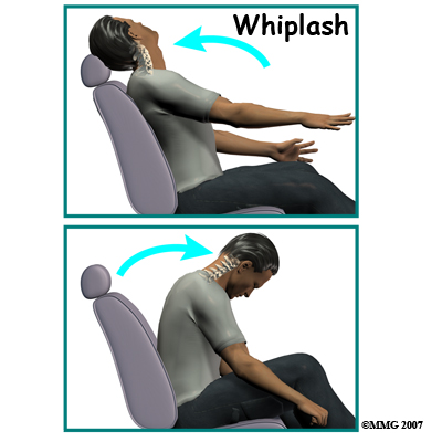 whiplash_intro01