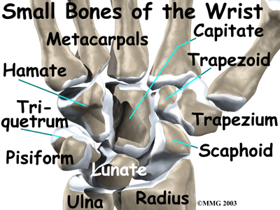 wrist_kienbocks_disease_anat02