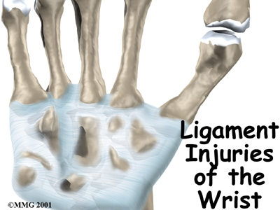 wrist_ligamentous_intro01