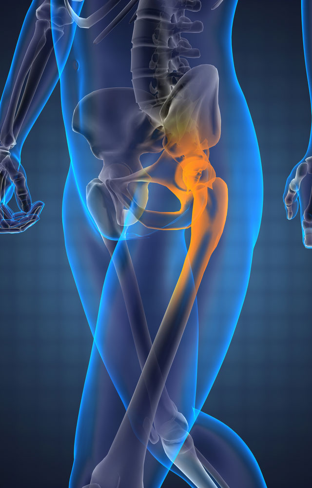 normal hip xray with pain and weakness