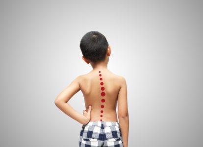 Boy with Scoliosis