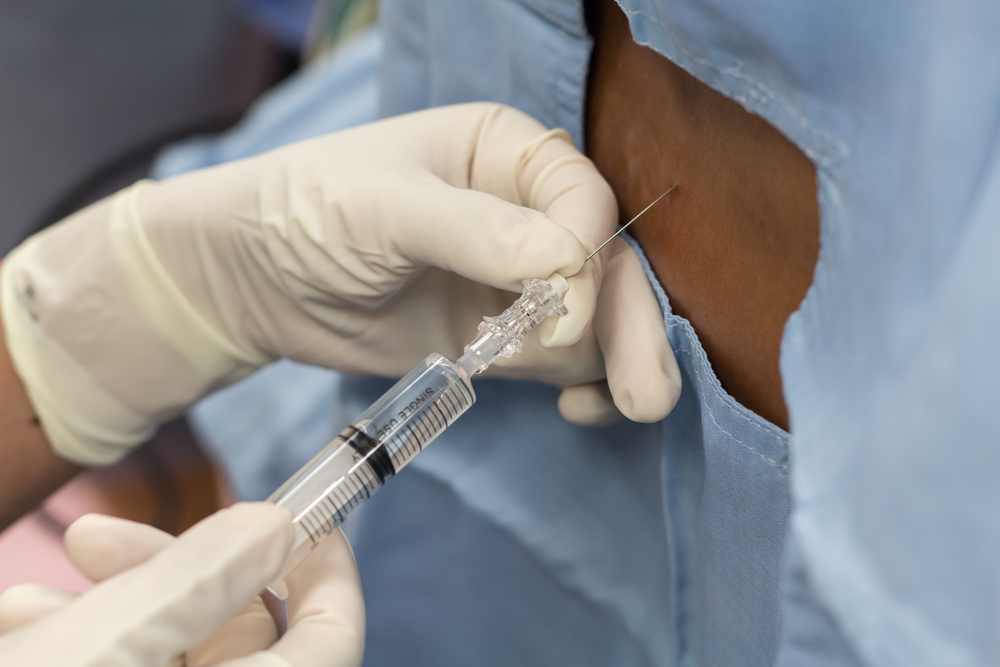 All About Spinal Epidural Injections for Back Pain Management