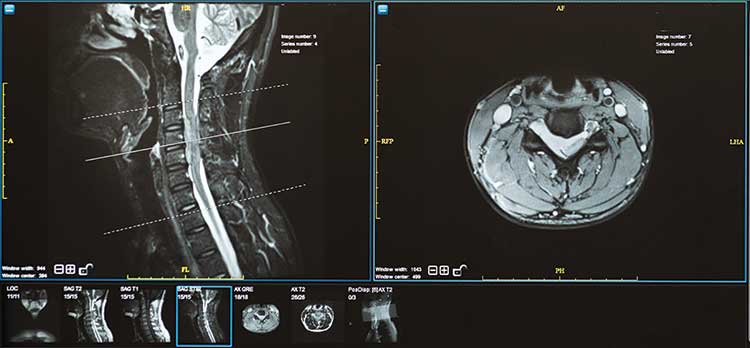 mri images