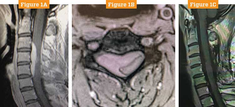 preoperative tumor images